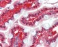 CBR3 Antibody (clone AT3C5)